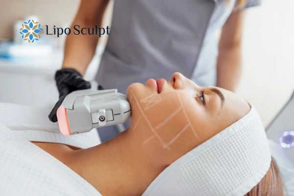 HIFU vs Botulinum Toxin: Understanding the Differences 1 HIFU vs Botox Abbots Langley What is the best option for you?