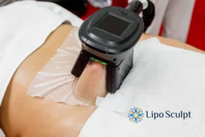 Cryolipolysis Helping You Getting that Perfect Summer Body 3 Cryolipolysis Abbots Langley can give you the best summer body - contact us today!
