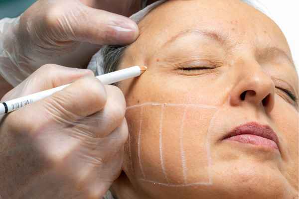 CryoPen: 5 Skin Concerns It May Be Used to Treat 4 What should you ask before having CryoPen treatment Abbots Langley?